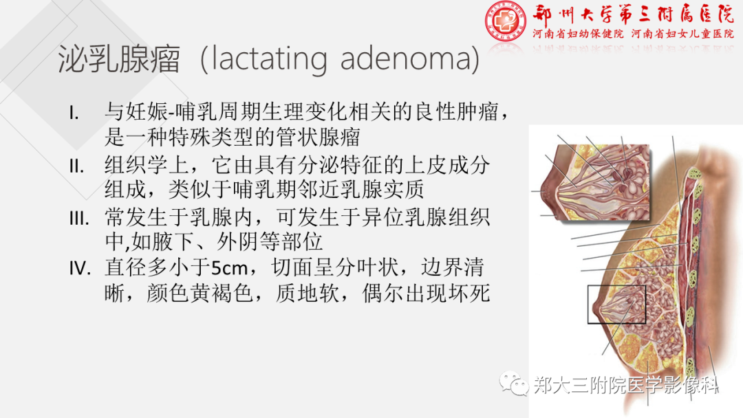 影像PPT - 【PPT】泌乳腺瘤-2