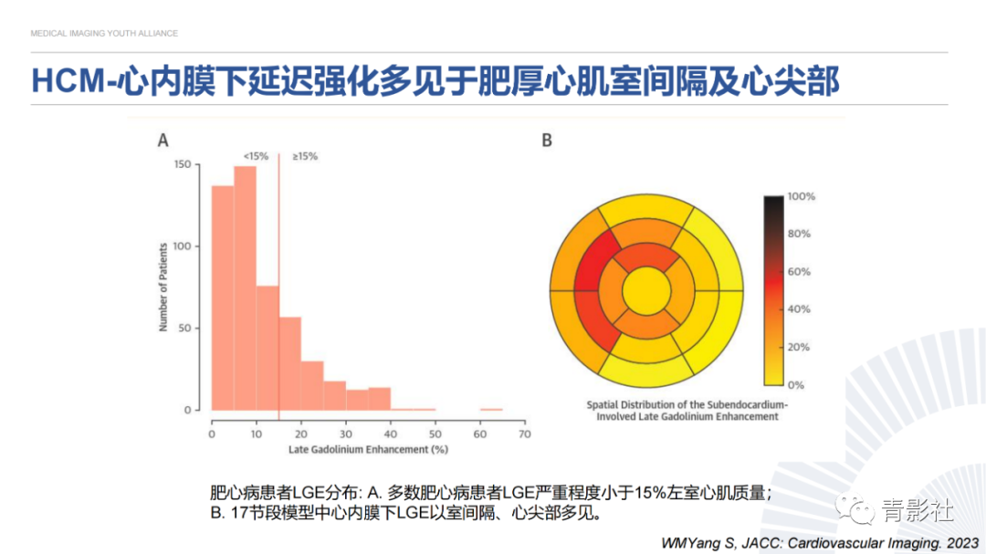 影像PPT - 【PPT】心内膜下延迟强化诊断思路-17