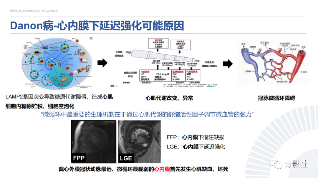影像PPT - 【PPT】心内膜下延迟强化诊断思路-23