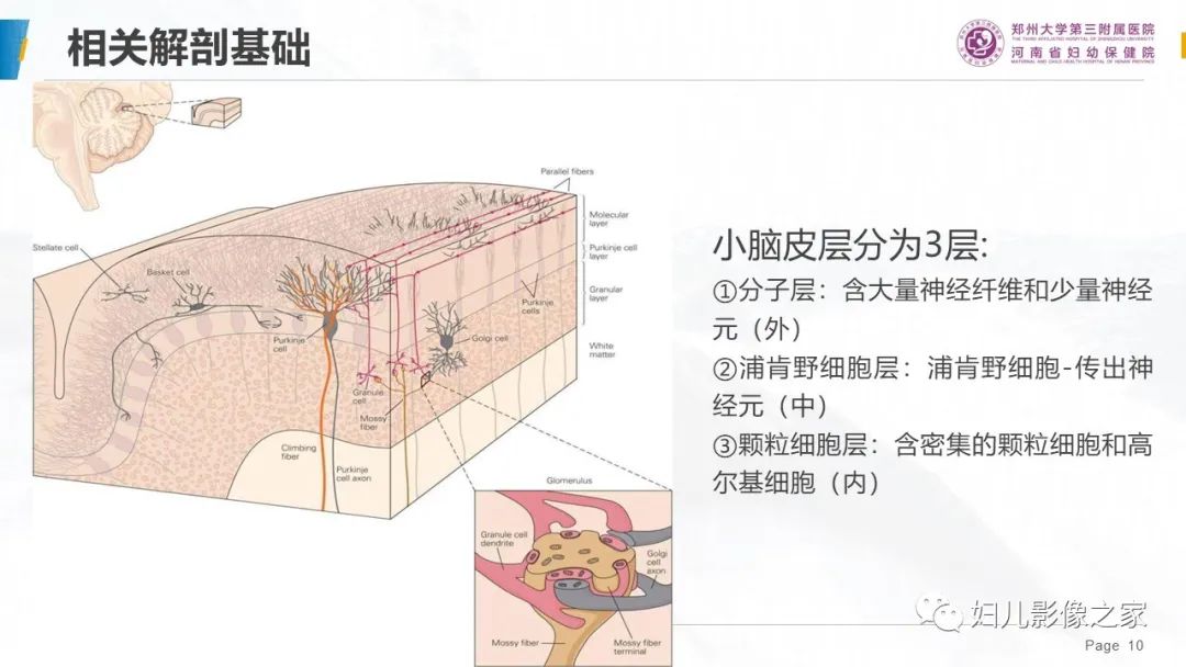 影像PPT - 【PPT】小脑发育不良性神经节细胞瘤的影像诊断-10