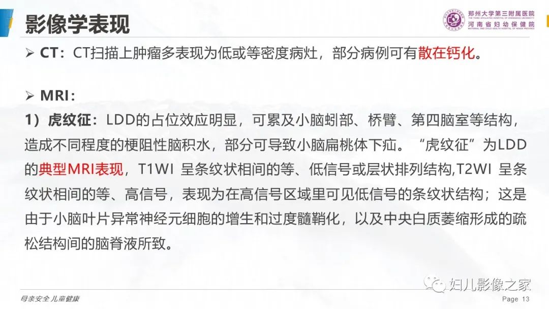 影像PPT - 【PPT】小脑发育不良性神经节细胞瘤的影像诊断-13