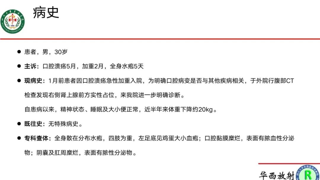 影像PPT - 【病例】腹膜后Castleman病1例CT影像-1