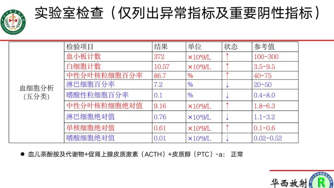 影像PPT - 【病例】腹膜后Castleman病1例CT影像-2