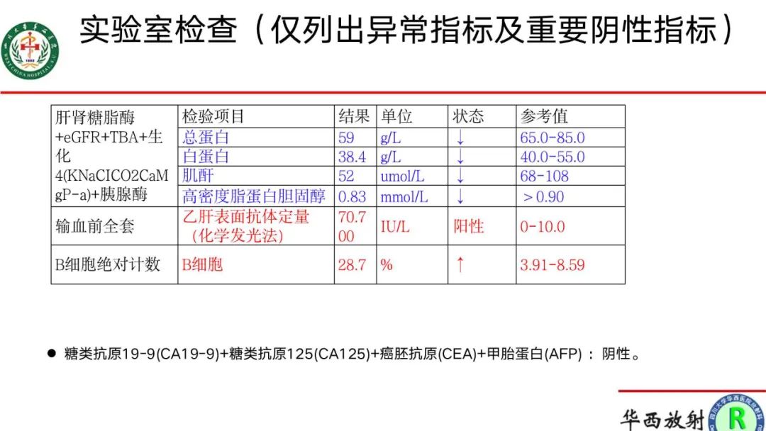 影像PPT - 【病例】腹膜后Castleman病1例CT影像-3