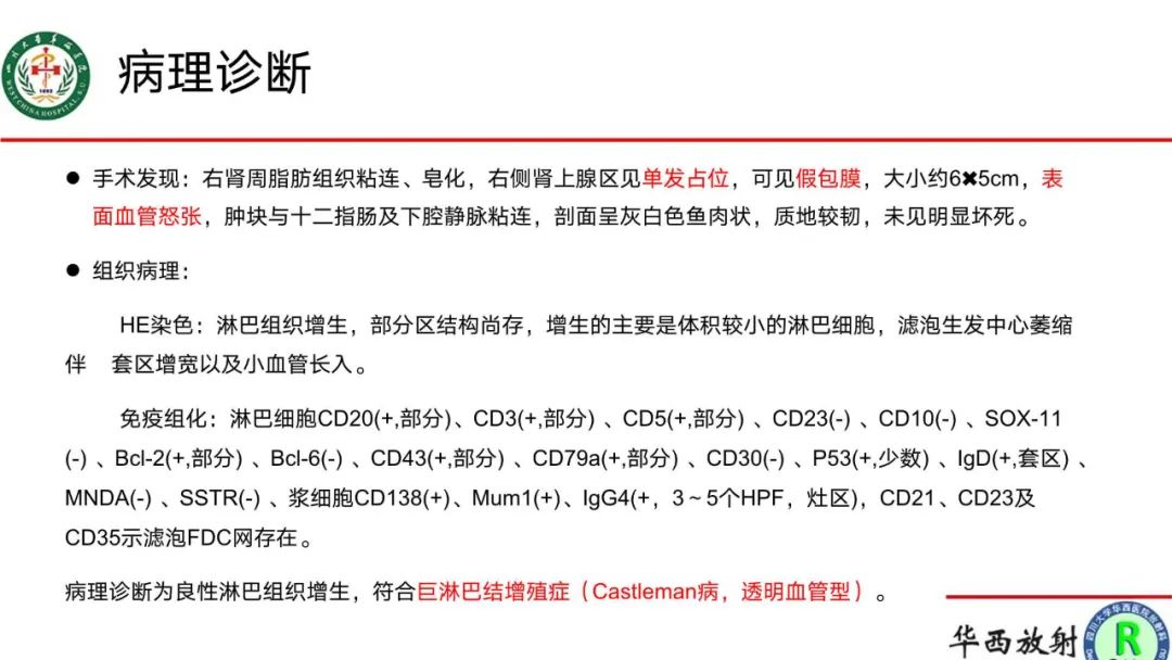 影像PPT - 【病例】腹膜后Castleman病1例CT影像-9