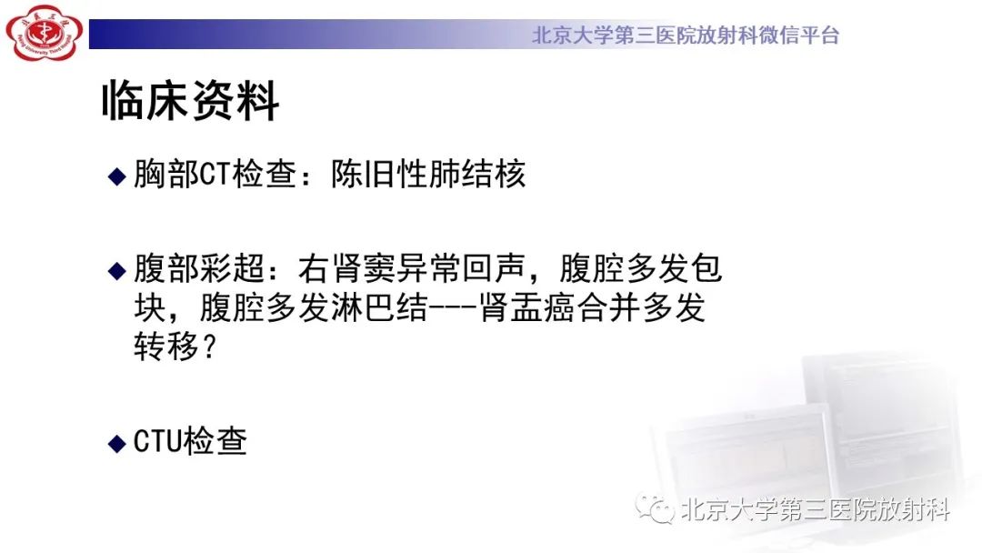 影像PPT - 【PPT】肾脏淋巴瘤-3