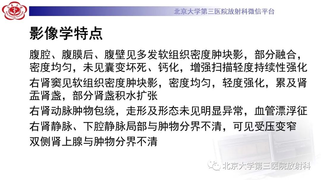 影像PPT - 【PPT】肾脏淋巴瘤-14