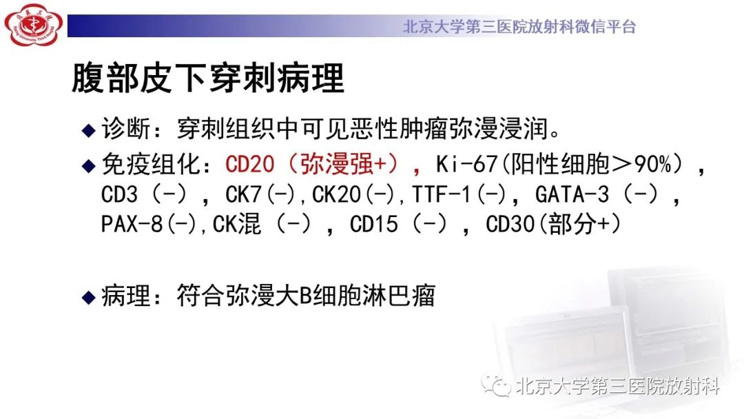 影像PPT - 【PPT】肾脏淋巴瘤-15