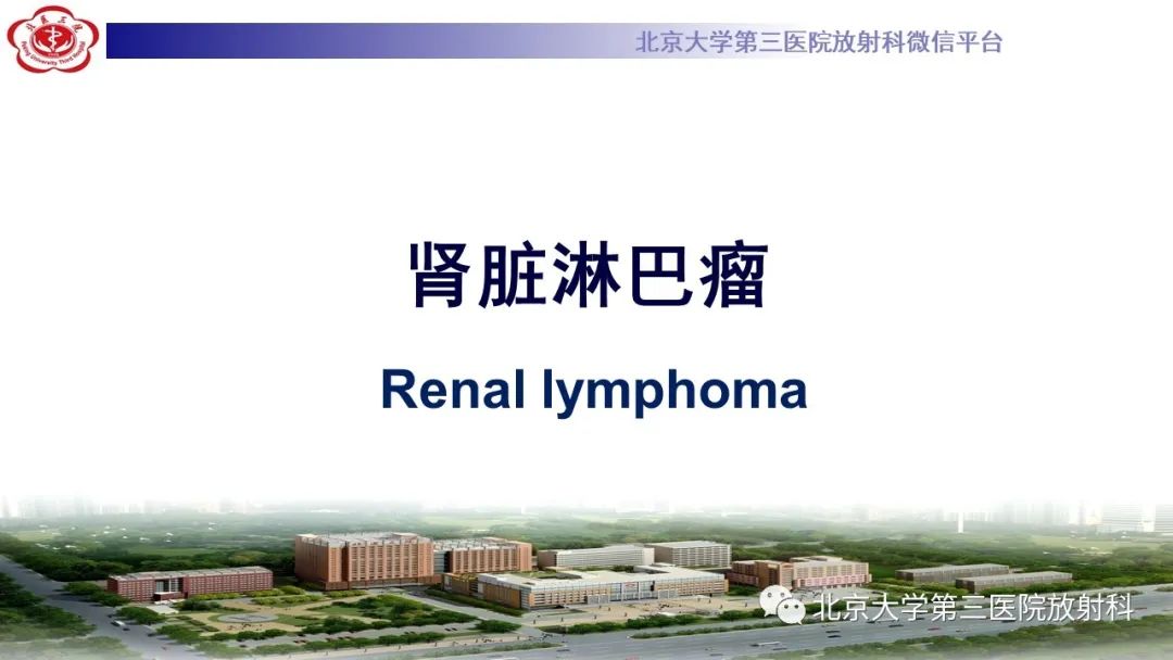 影像PPT - 【PPT】肾脏淋巴瘤-16