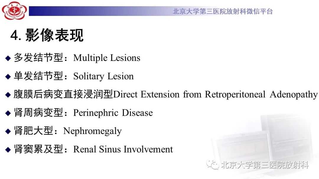 影像PPT - 【PPT】肾脏淋巴瘤-21