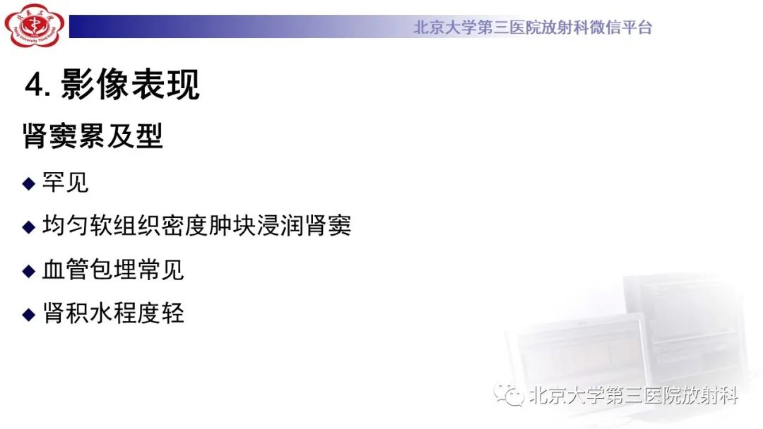 影像PPT - 【PPT】肾脏淋巴瘤-32