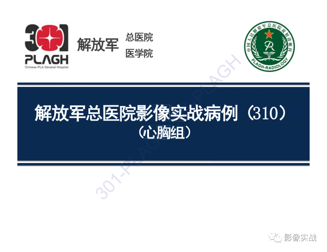 影像PPT - 【病例】胸腺瘤1例CT影像-1