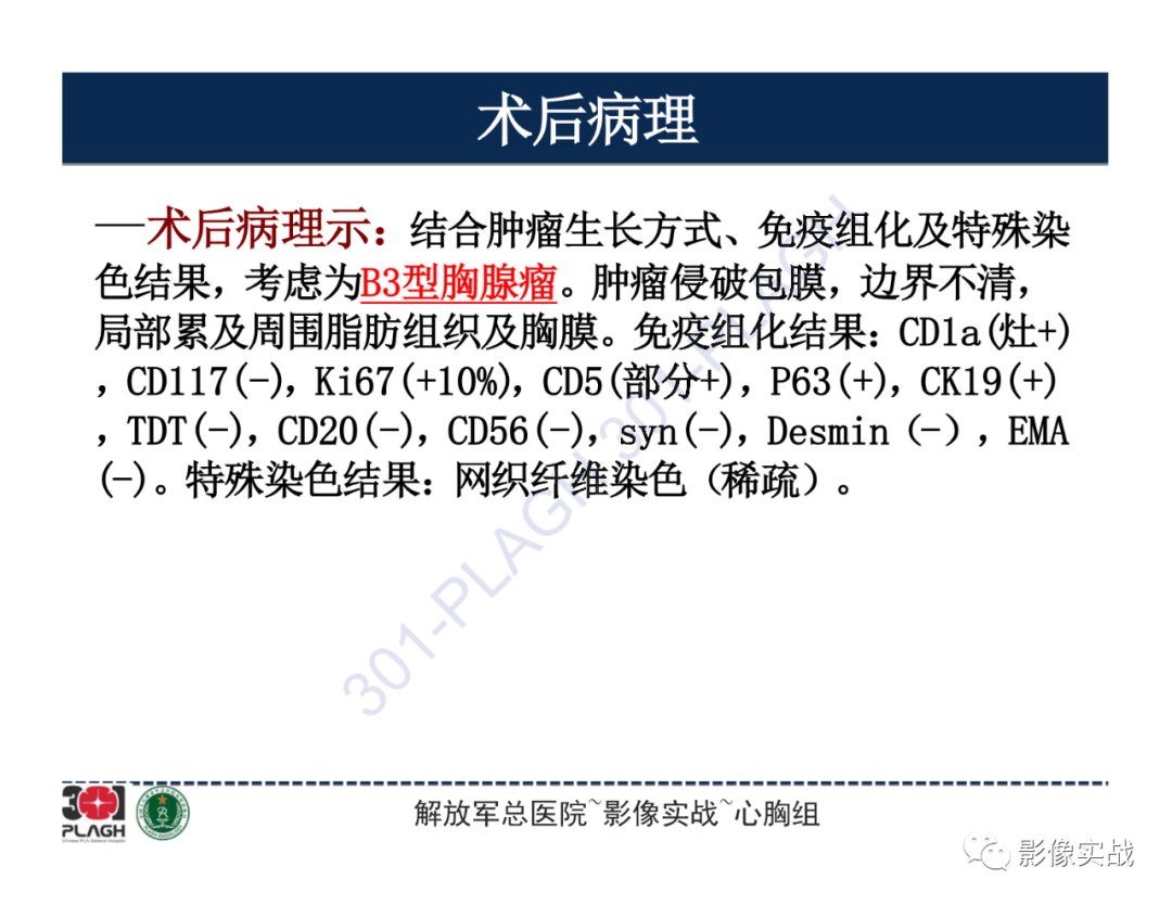 影像PPT - 【病例】胸腺瘤1例CT影像-15