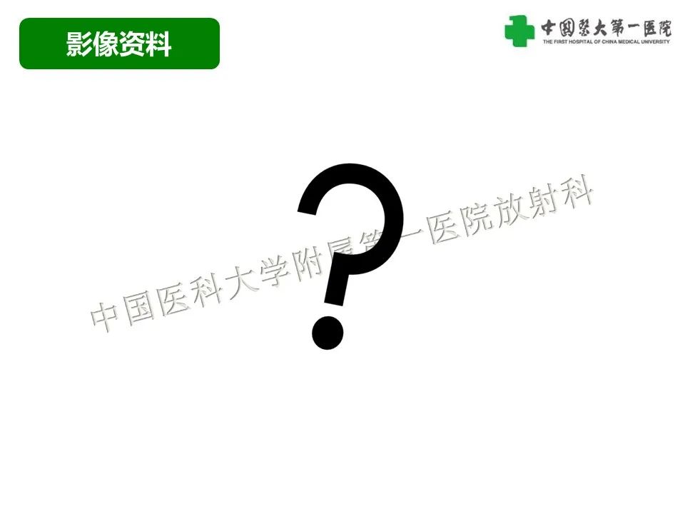 影像PPT - 【病例】腹膜后脂肪肉瘤1例CT影像-9