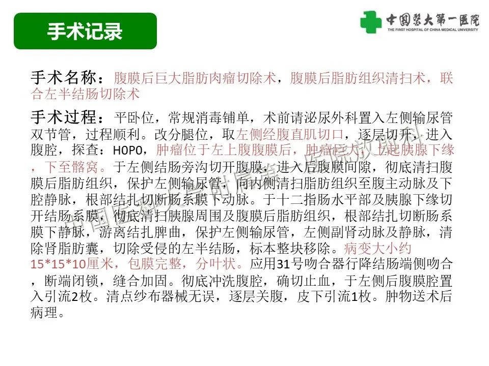 影像PPT - 【病例】腹膜后脂肪肉瘤1例CT影像-10