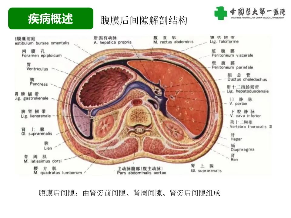 影像PPT - 【病例】腹膜后脂肪肉瘤1例CT影像-12