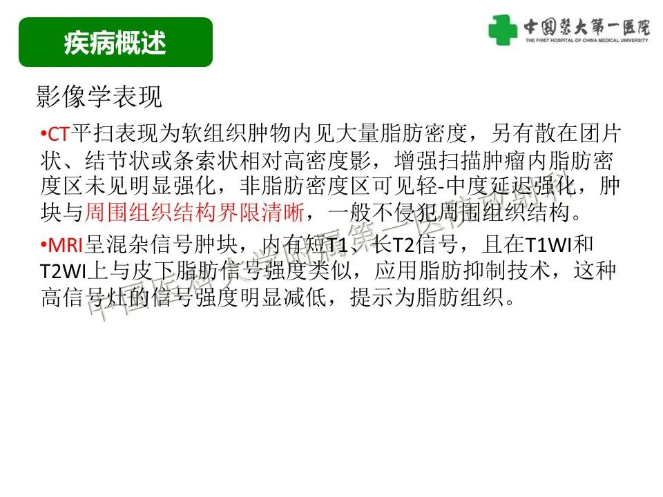 影像PPT - 【病例】腹膜后脂肪肉瘤1例CT影像-21