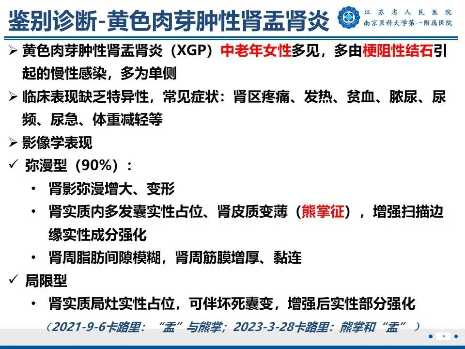 影像PPT - 【PPT】肾结核-33