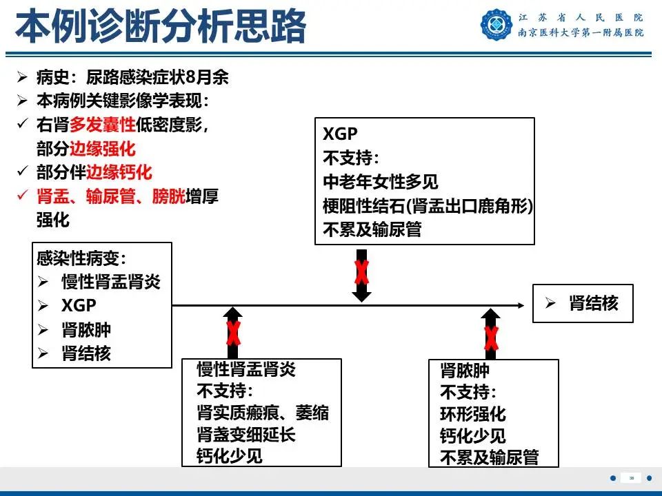 影像PPT - 【PPT】肾结核-39