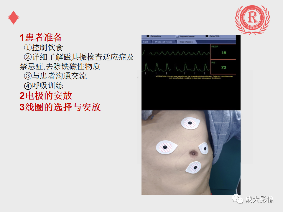 影像PPT - 【PPT】心脏MRI检查规范-3