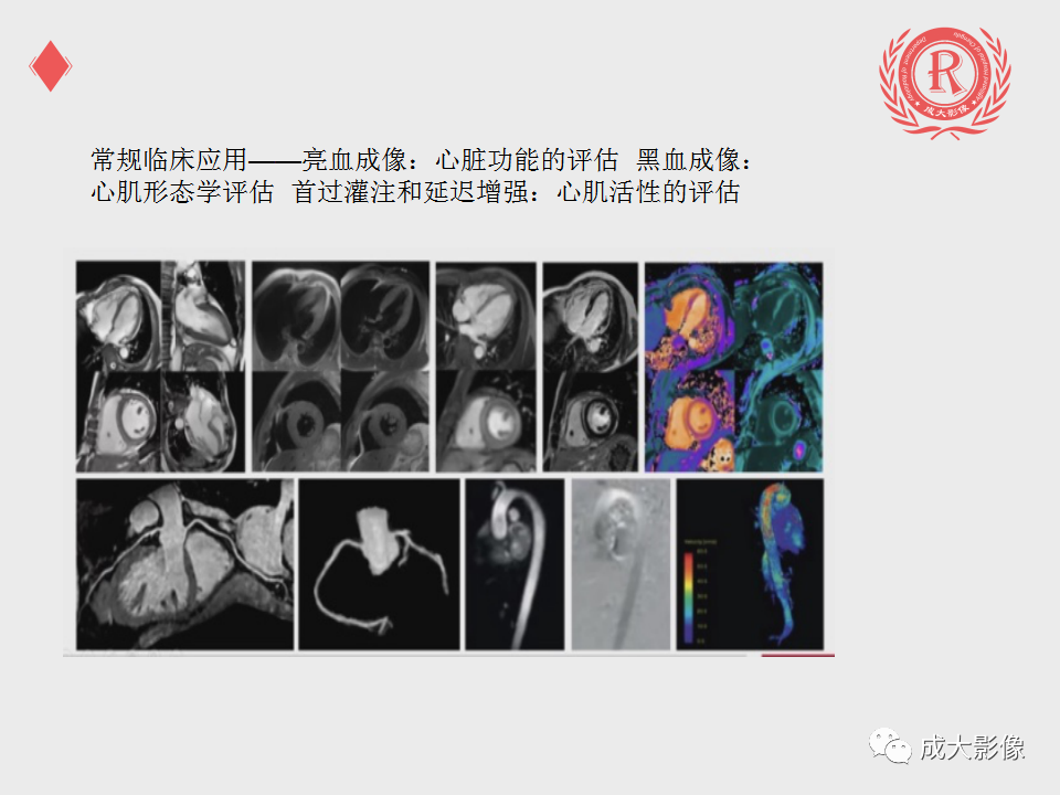 影像PPT - 【PPT】心脏MRI检查规范-4