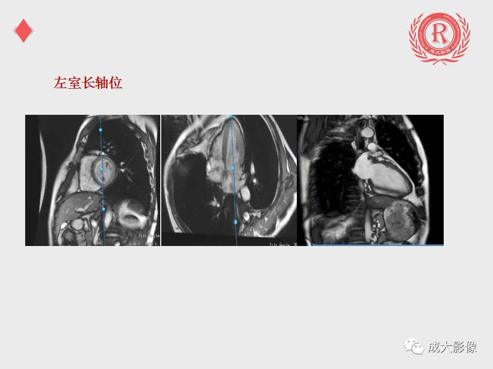 影像PPT - 【PPT】心脏MRI检查规范-7