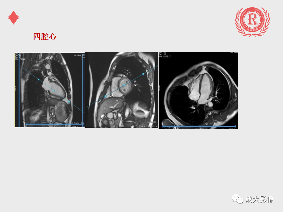 影像PPT - 【PPT】心脏MRI检查规范-8