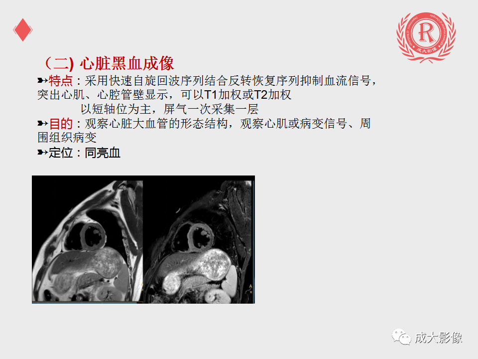 影像PPT - 【PPT】心脏MRI检查规范-12