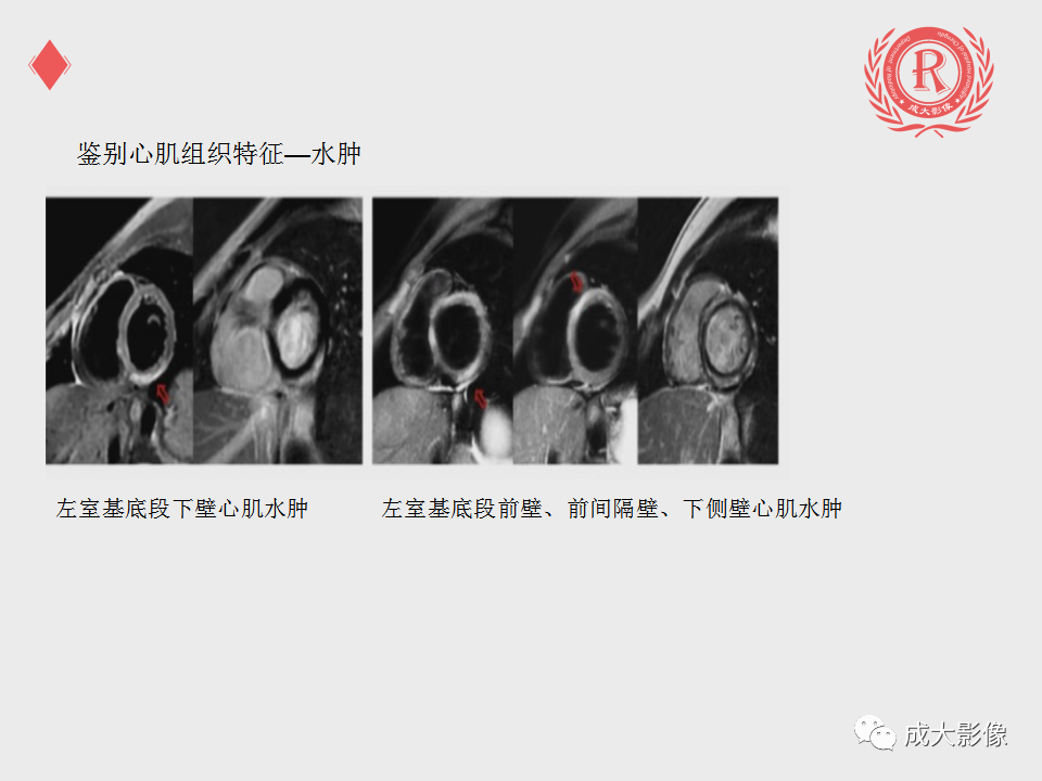 影像PPT - 【PPT】心脏MRI检查规范-13