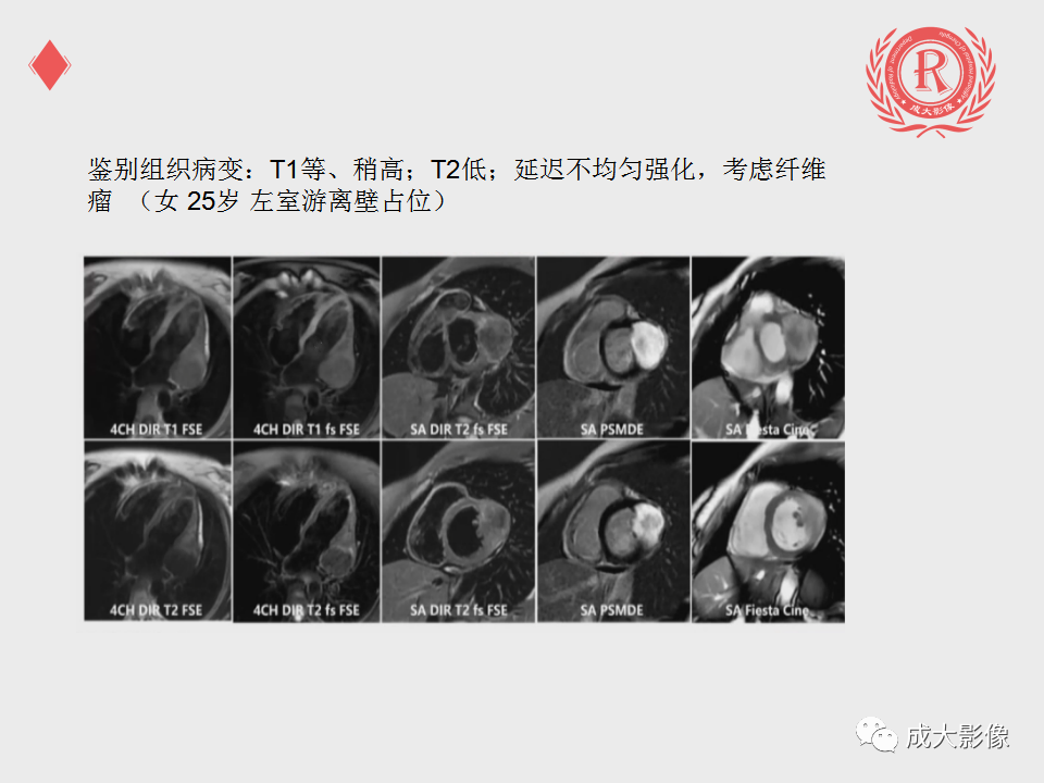 影像PPT - 【PPT】心脏MRI检查规范-14