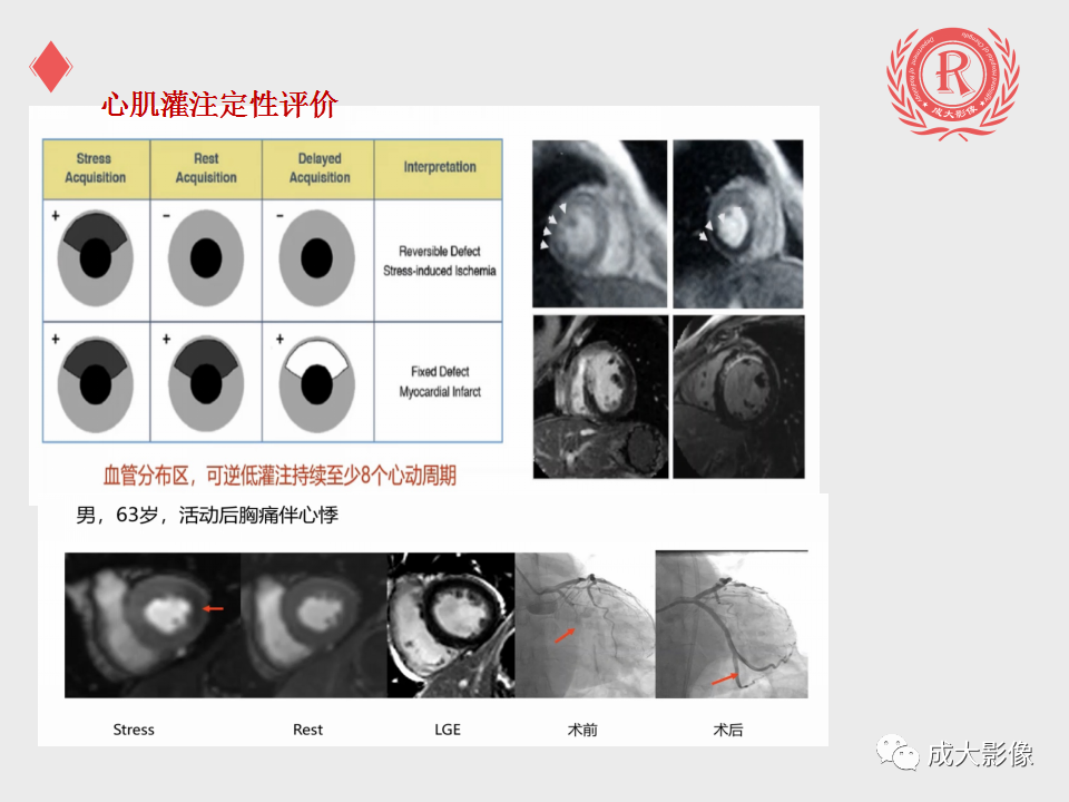 影像PPT - 【PPT】心脏MRI检查规范-19