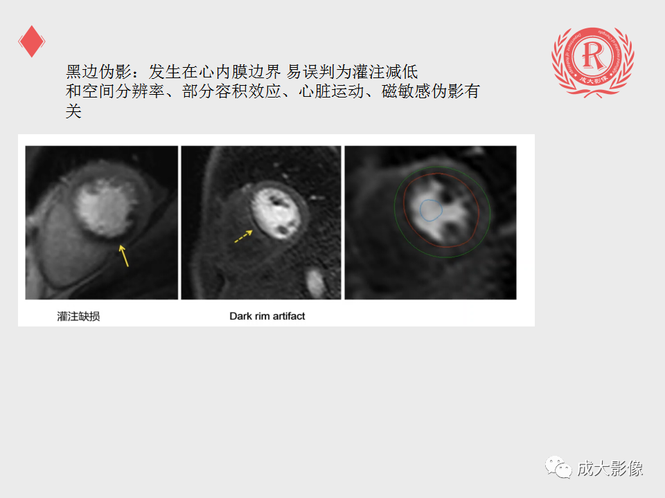 影像PPT - 【PPT】心脏MRI检查规范-20