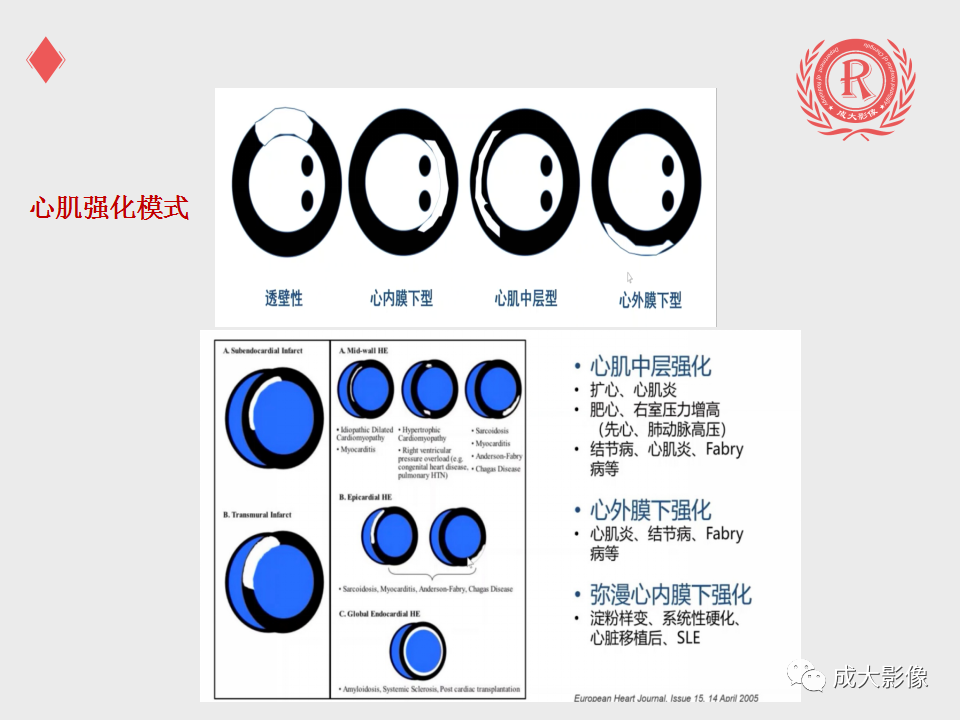 影像PPT - 【PPT】心脏MRI检查规范-22