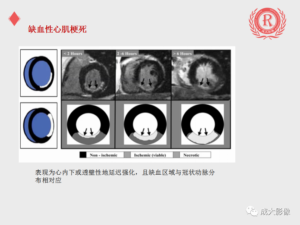 影像PPT - 【PPT】心脏MRI检查规范-23