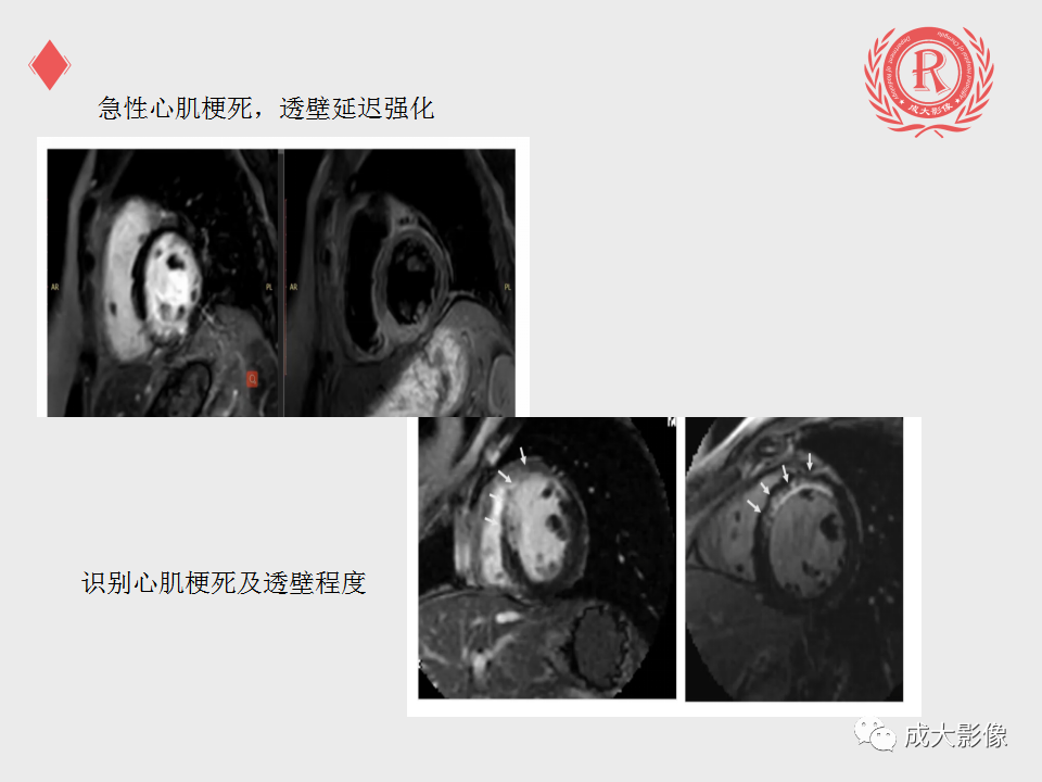 影像PPT - 【PPT】心脏MRI检查规范-24
