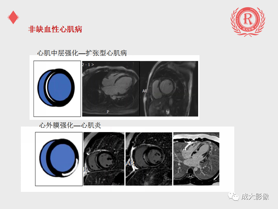 影像PPT - 【PPT】心脏MRI检查规范-25