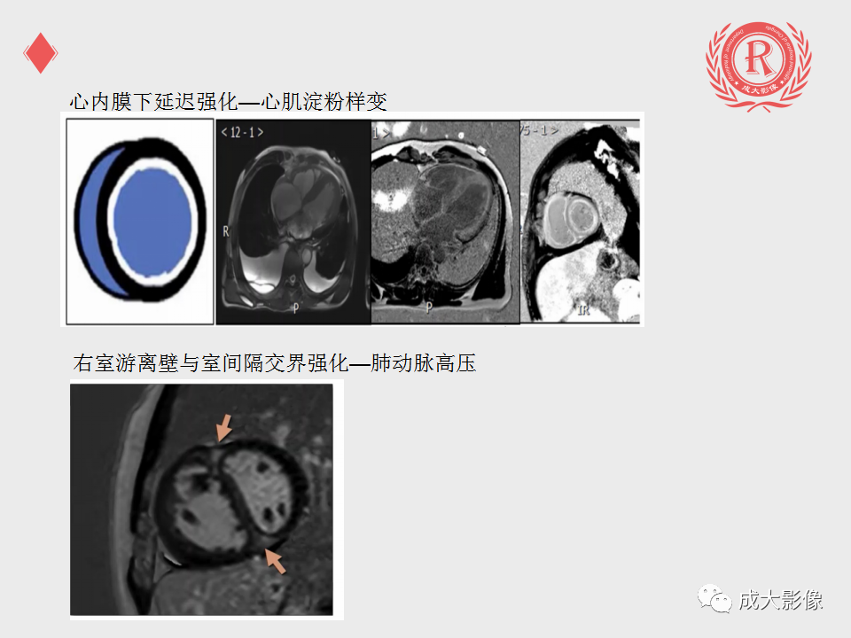 影像PPT - 【PPT】心脏MRI检查规范-26