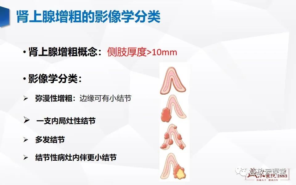 影像PPT - 【PPT】肾上腺增粗影像表现及意义-7