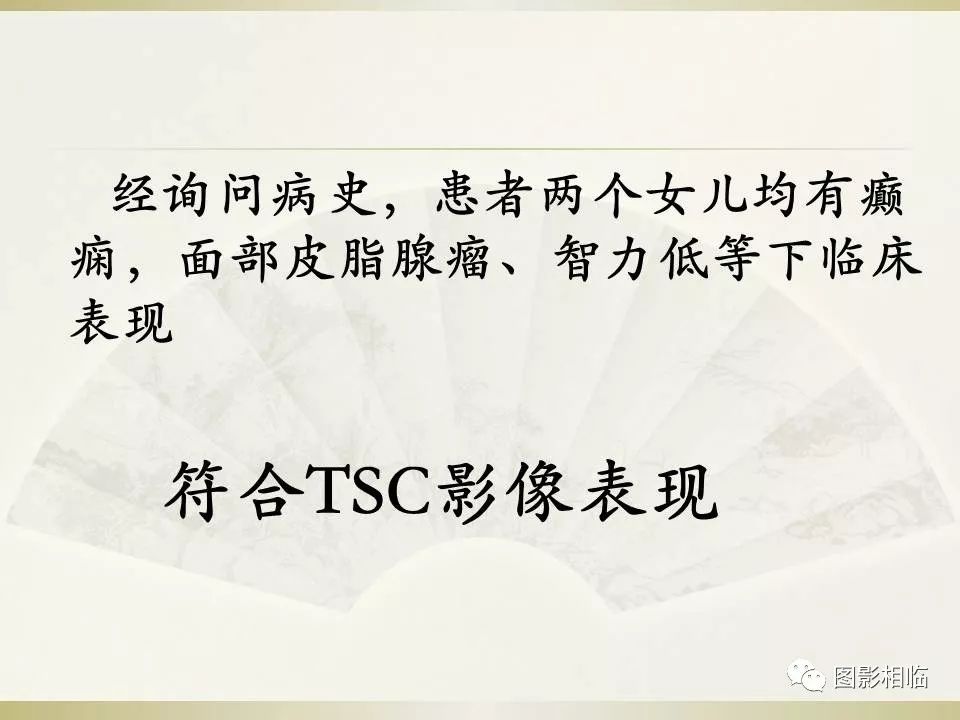 影像PPT - 【PPT】TSC临床及影像表现-6