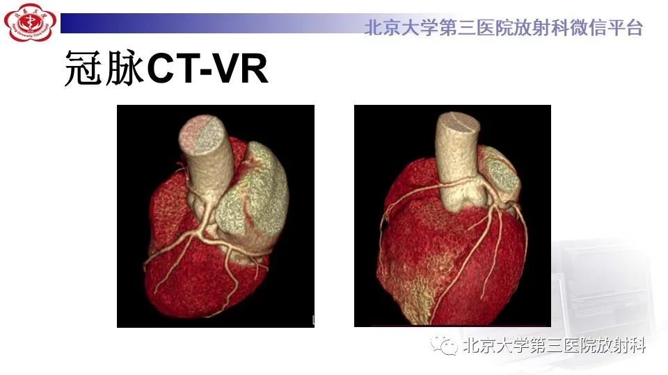 影像PPT - 【PPT】冠状动脉解剖异常-2