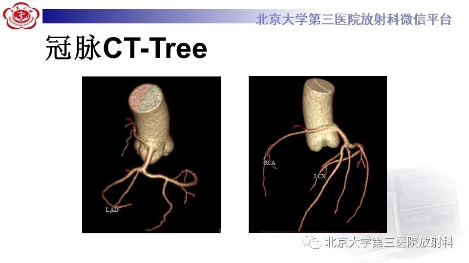 影像PPT - 【PPT】冠状动脉解剖异常-3