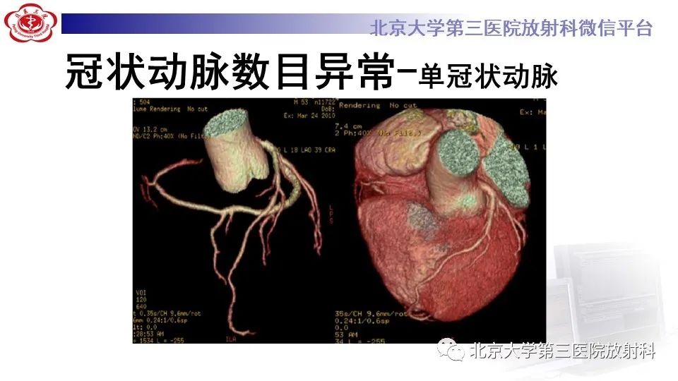 影像PPT - 【PPT】冠状动脉解剖异常-11