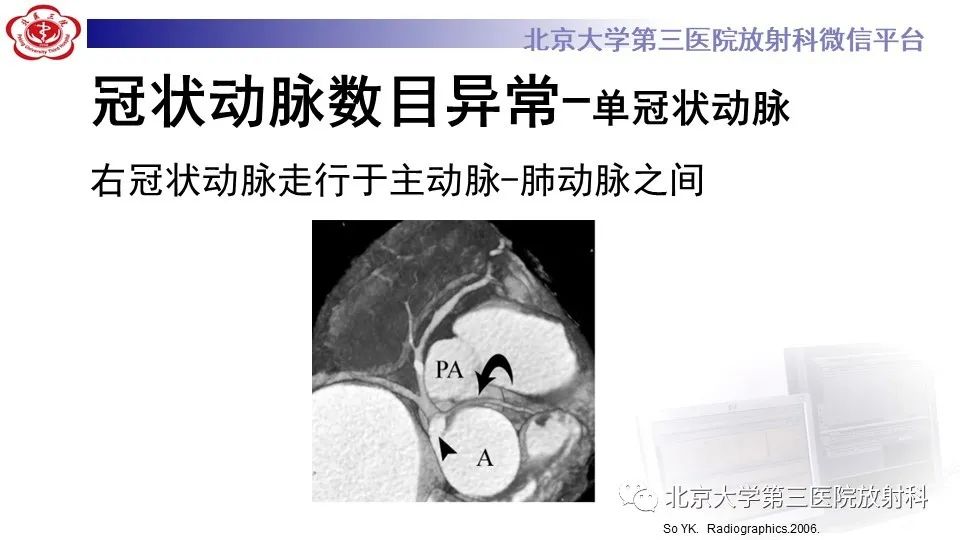 影像PPT - 【PPT】冠状动脉解剖异常-12