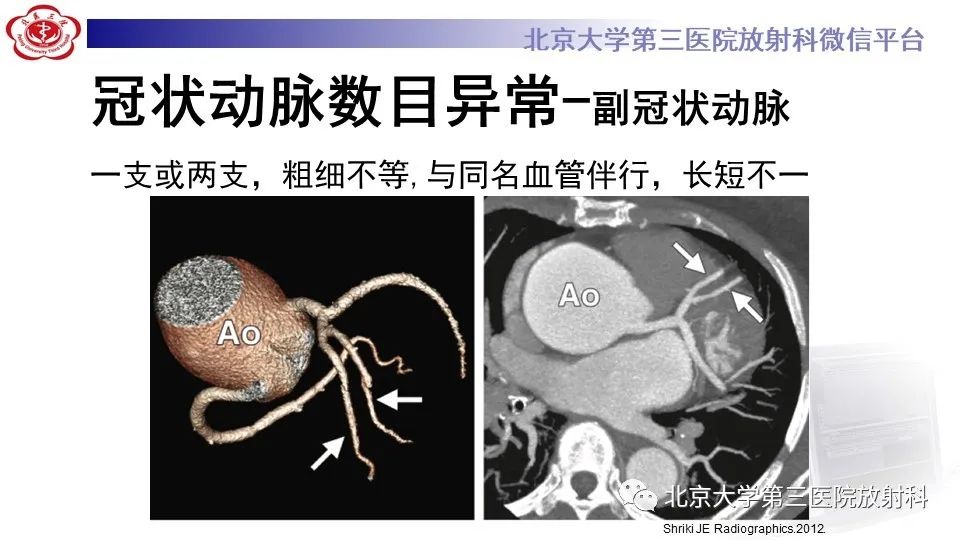 影像PPT - 【PPT】冠状动脉解剖异常-16