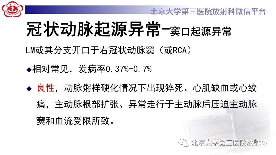 影像PPT - 【PPT】冠状动脉解剖异常-27