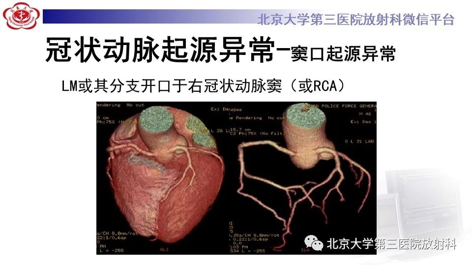 影像PPT - 【PPT】冠状动脉解剖异常-28