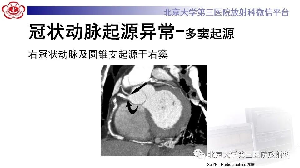 影像PPT - 【PPT】冠状动脉解剖异常-34