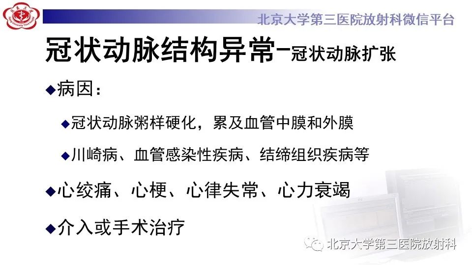 影像PPT - 【PPT】冠状动脉解剖异常-49