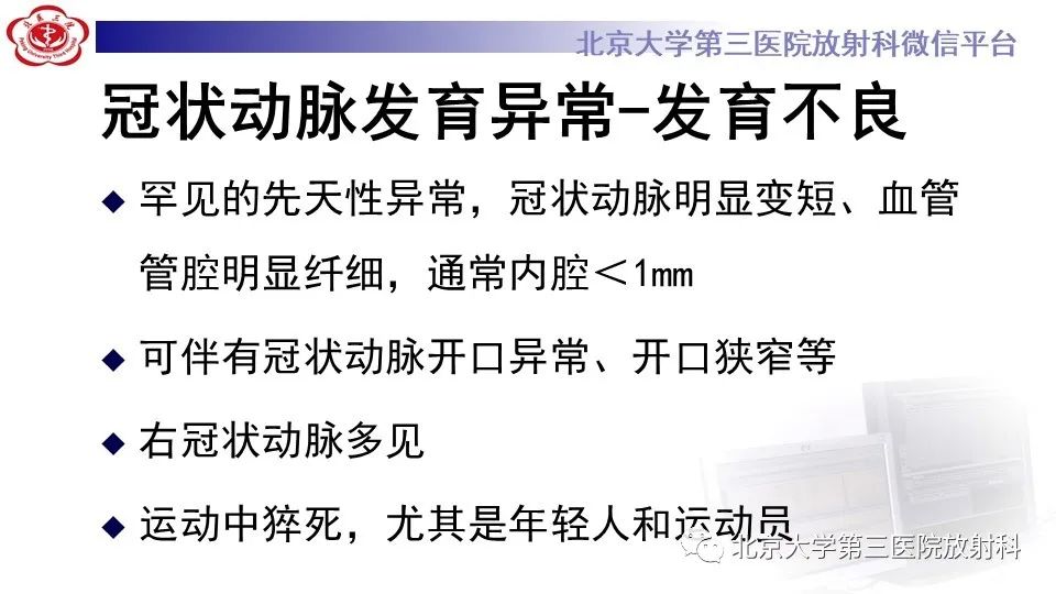 影像PPT - 【PPT】冠状动脉解剖异常-54