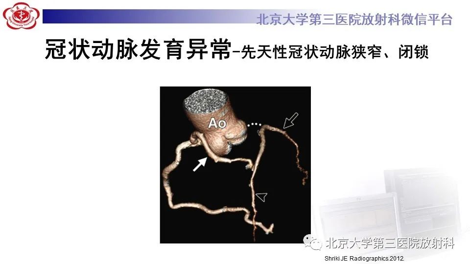 影像PPT - 【PPT】冠状动脉解剖异常-57